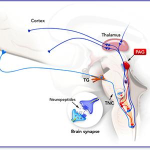 Migraine Headache Support - What Is The Chronic Headache Cause And Where To Find Treatment Information