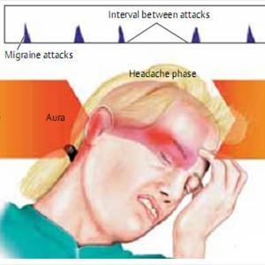 Treat Headache With Magnesium - Do What You Can To Make A Difference - It Will Make A Difference For You