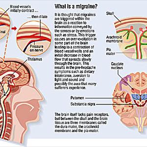 Medication For Migraine Headaches - Home Cures For Migraines  That Are Natural And Get Rid Of Pain Quickly